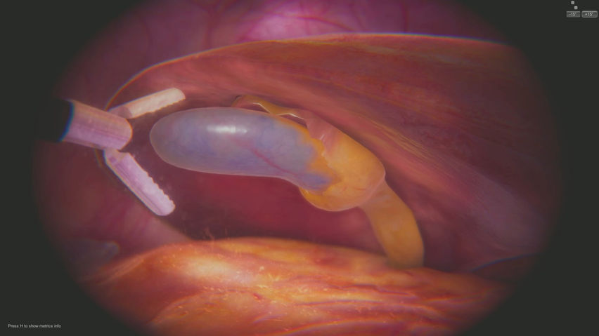SurgicaVR