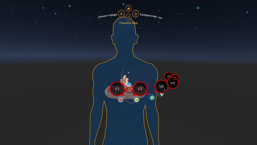 Awake ECG