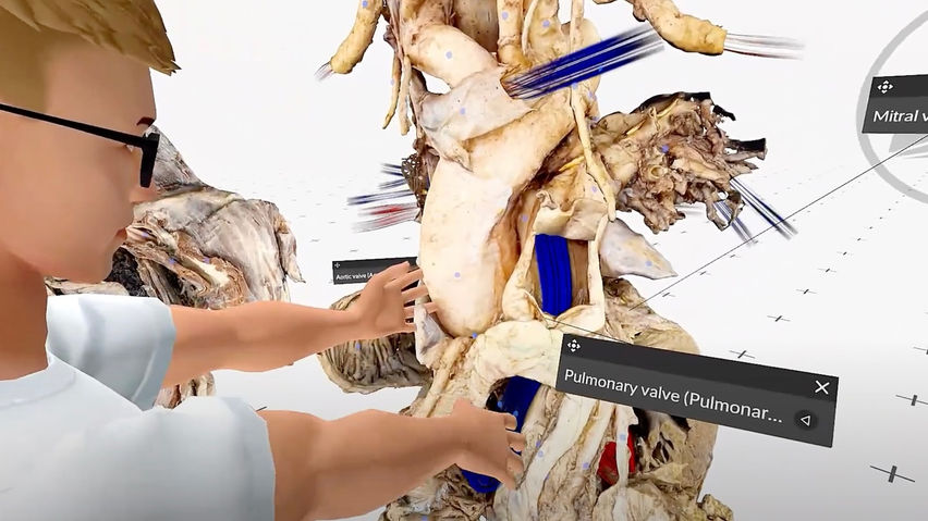 MEDICALHOLODECK. ANATOMY, IMAGING, AI