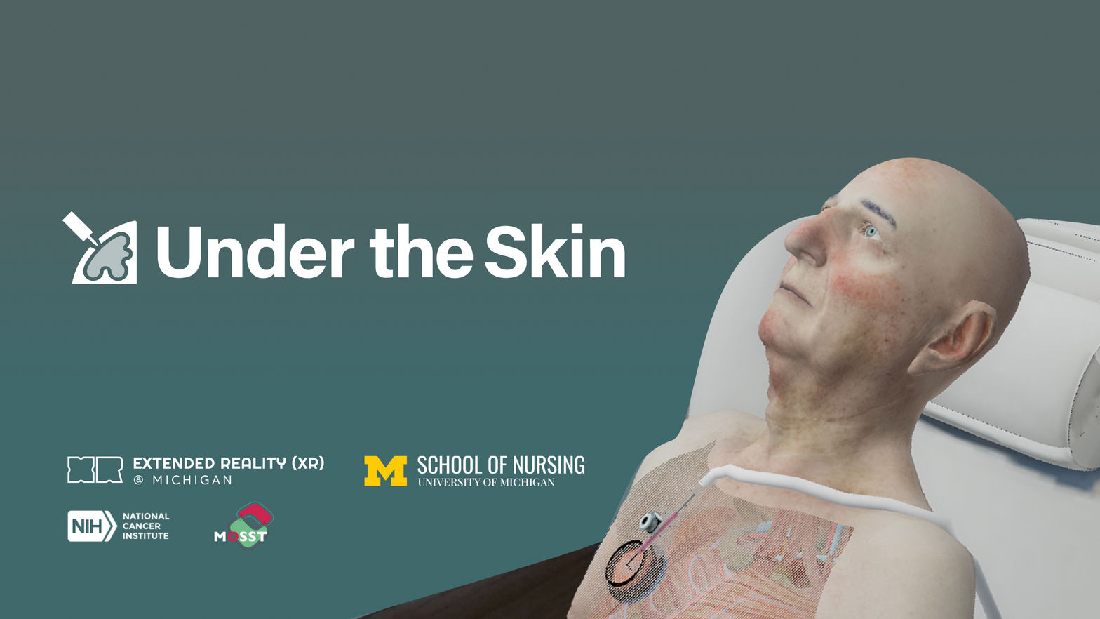 Under the Skin