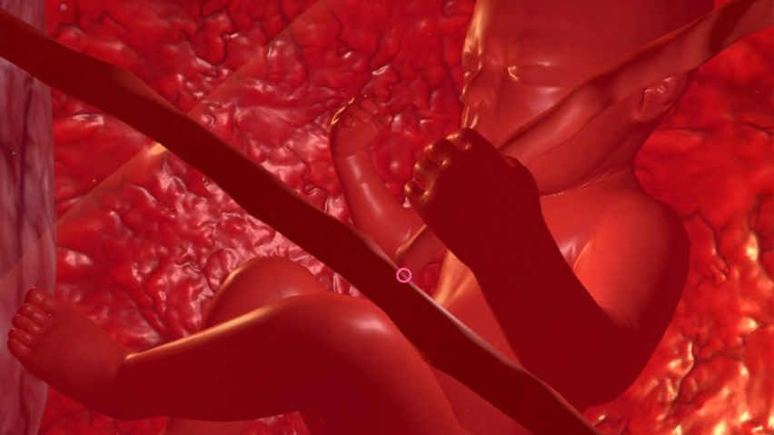 PregnancyVue