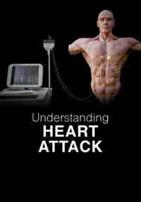 Understanding Heart Attack