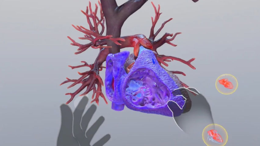 Understanding Heart Attack