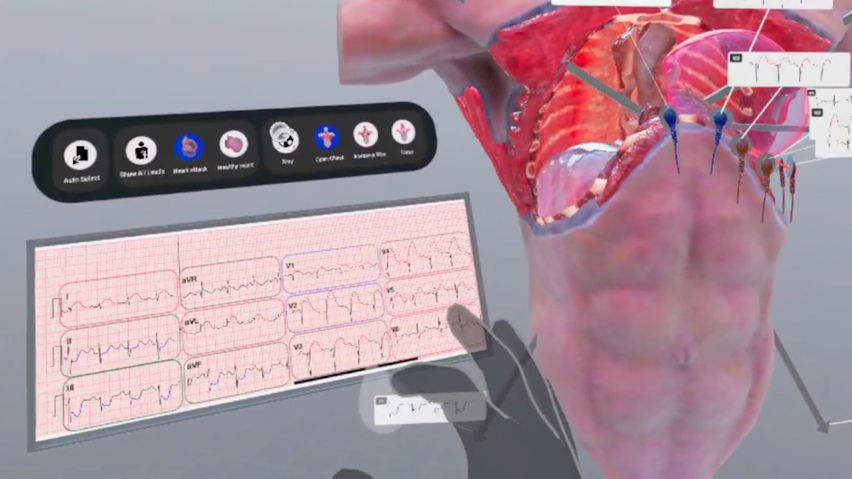 Understanding Heart Attack