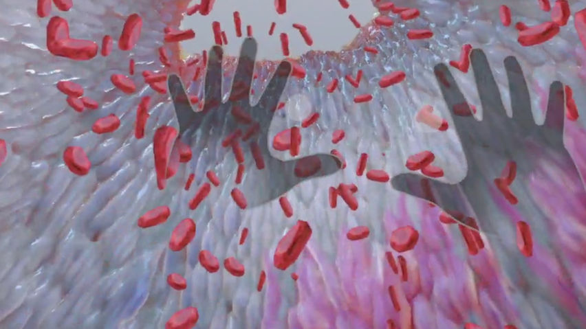 Understanding Heart Attack