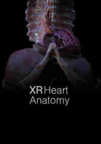 XR Heart Anatomy