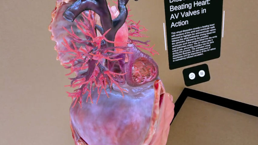 XR Heart Anatomy