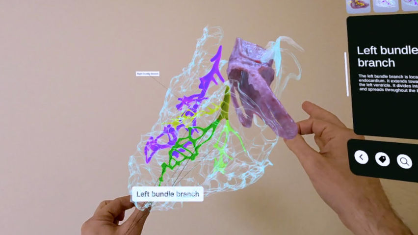 XR Heart Anatomy