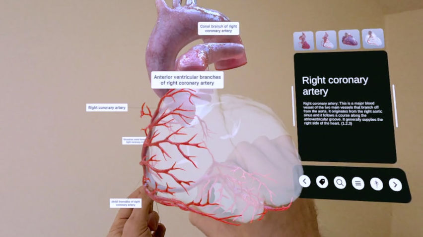 XR Heart Anatomy