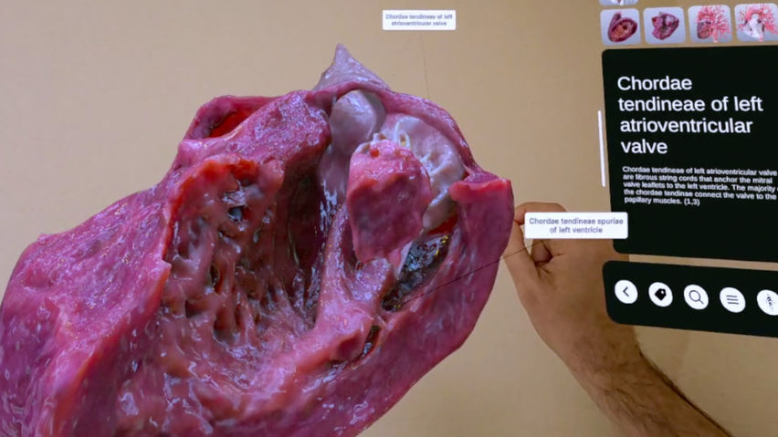 XR Heart Anatomy