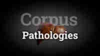 Pathologies