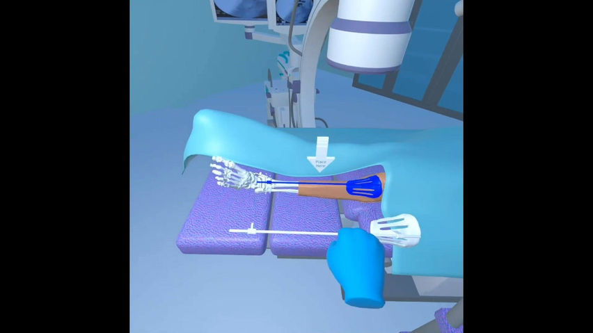 3d surgical