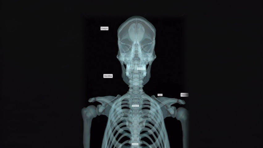 XR Anatomy