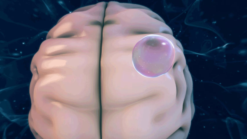 NEUROPILOT