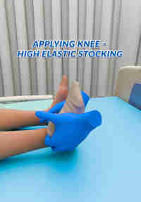 Applying Knee – High Elastic Stocking