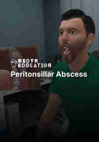 Peritonsillar Abscess Needle Aspiration