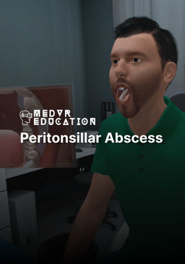Peritonsillar Abscess Needle Aspiration
