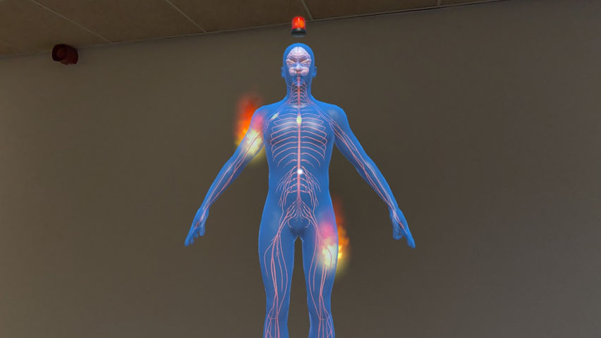 Spinal Cord Injury Education