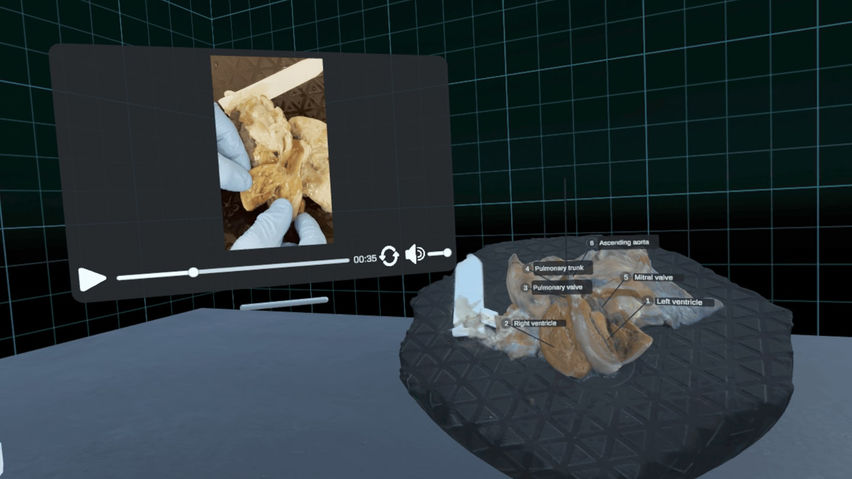 Cardioscape VR
