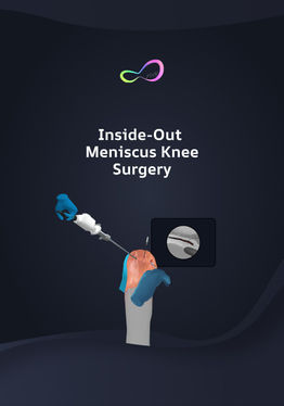 Meniscus Repair Inside Out