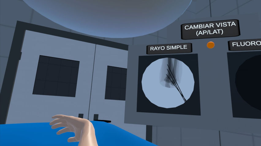 VR Fix Supra