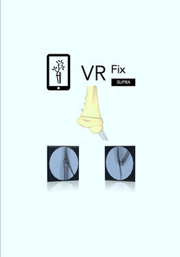 VR Fix Supra