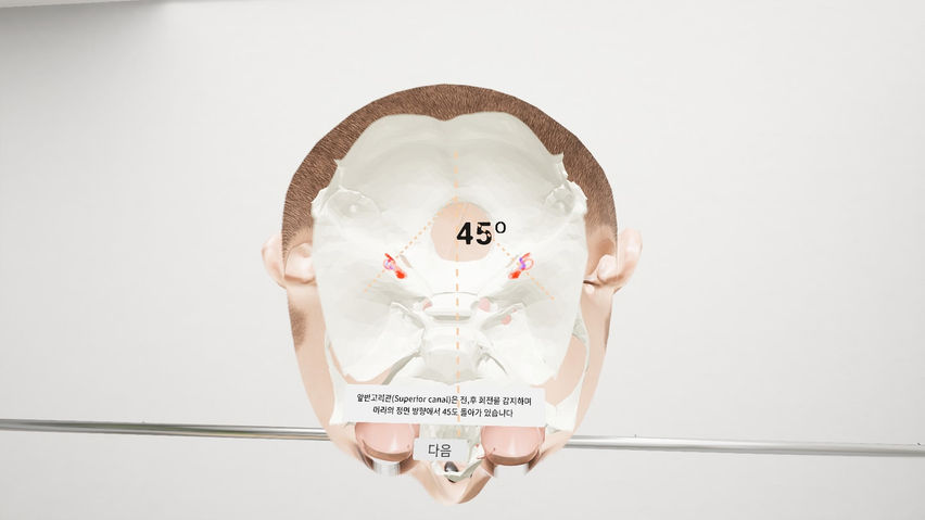VR-BPPV
