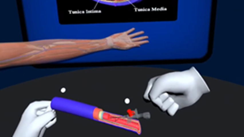 XR Cannulation