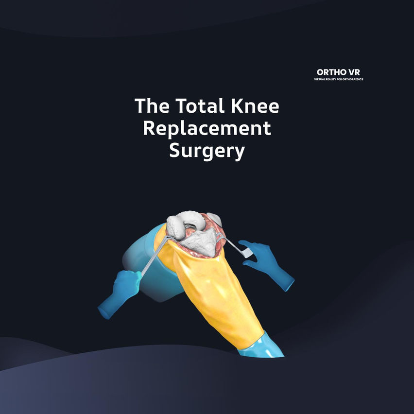 Total Knee Replacement Surgery