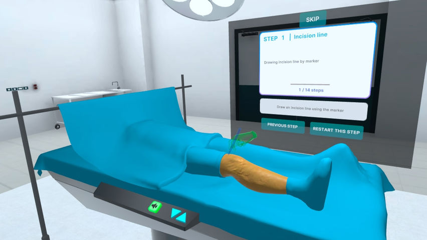 Total Knee Replacement Surgery
