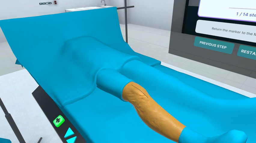Total Knee Replacement Surgery