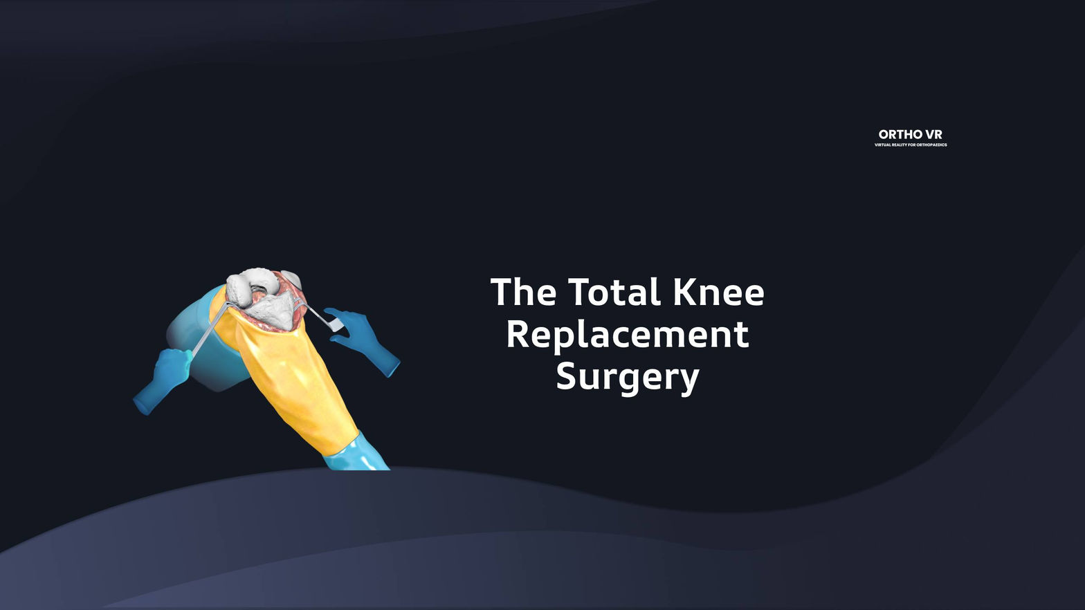 Total Knee Replacement Surgery