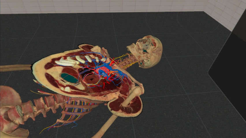 VH Dissector XR