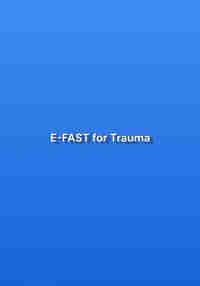 E-FAST for Trauma
