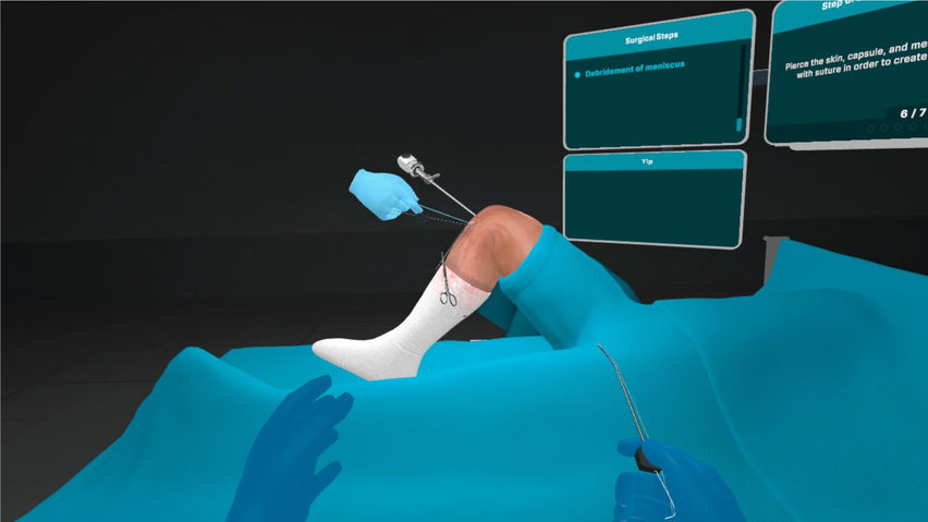 Meniscus Repair Outside In