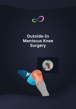 Meniscus Repair Outside In