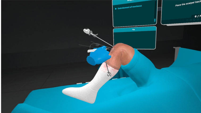 Meniscus Repair Outside In