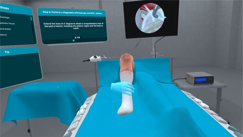 Bucket Handle Meniscus Tear Surgery