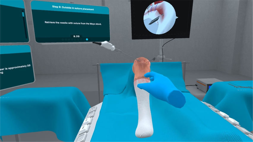 Bucket Handle Meniscus Tear Surgery