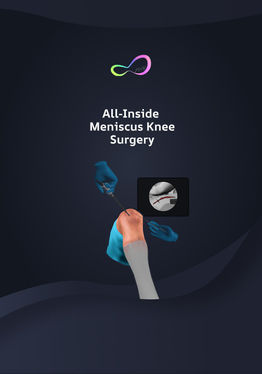 All Inside Meniscus Repair Surgery