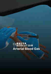 Arterial Blood Gas