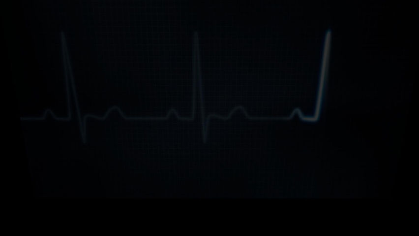 After Death
