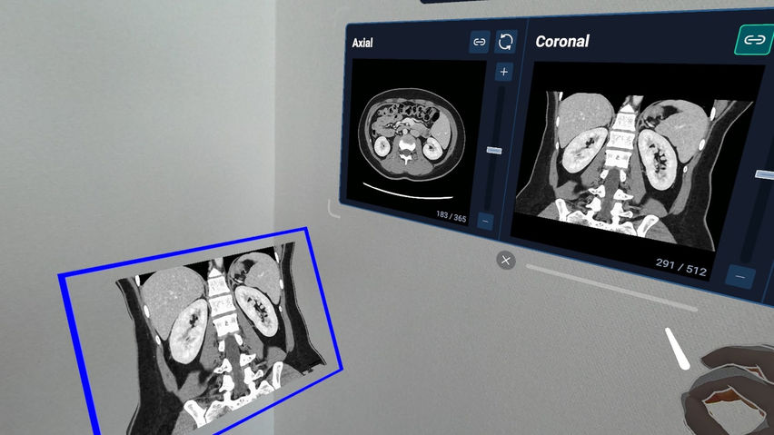 HoloMedicine® Patient Viewer