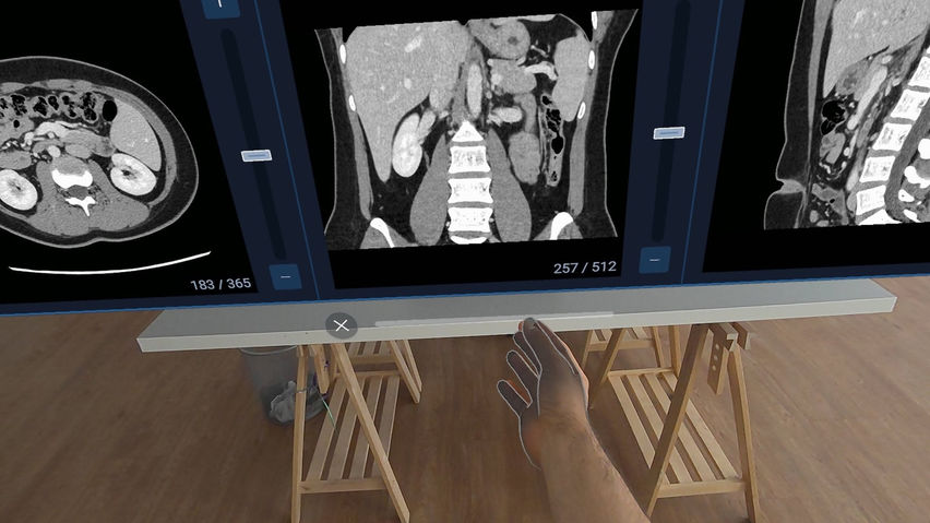 HoloMedicine® Patient Viewer