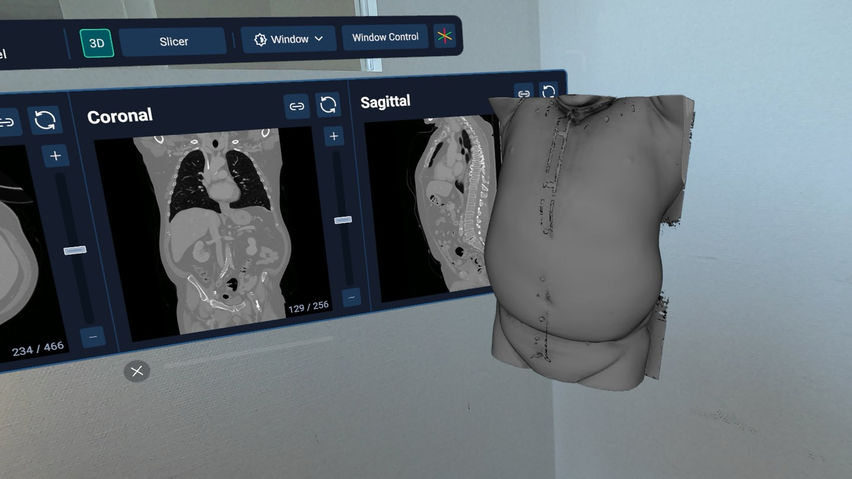 HoloMedicine® Patient Viewer