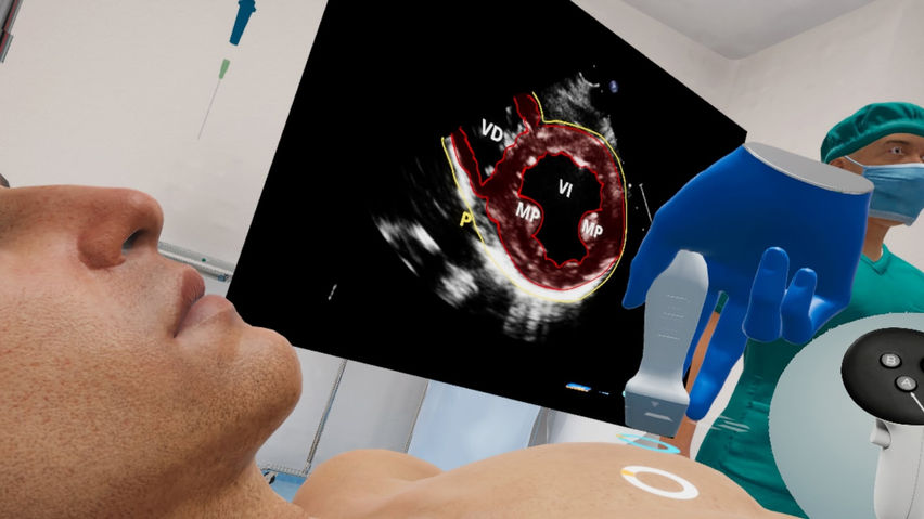 Echocardiography VR - VML