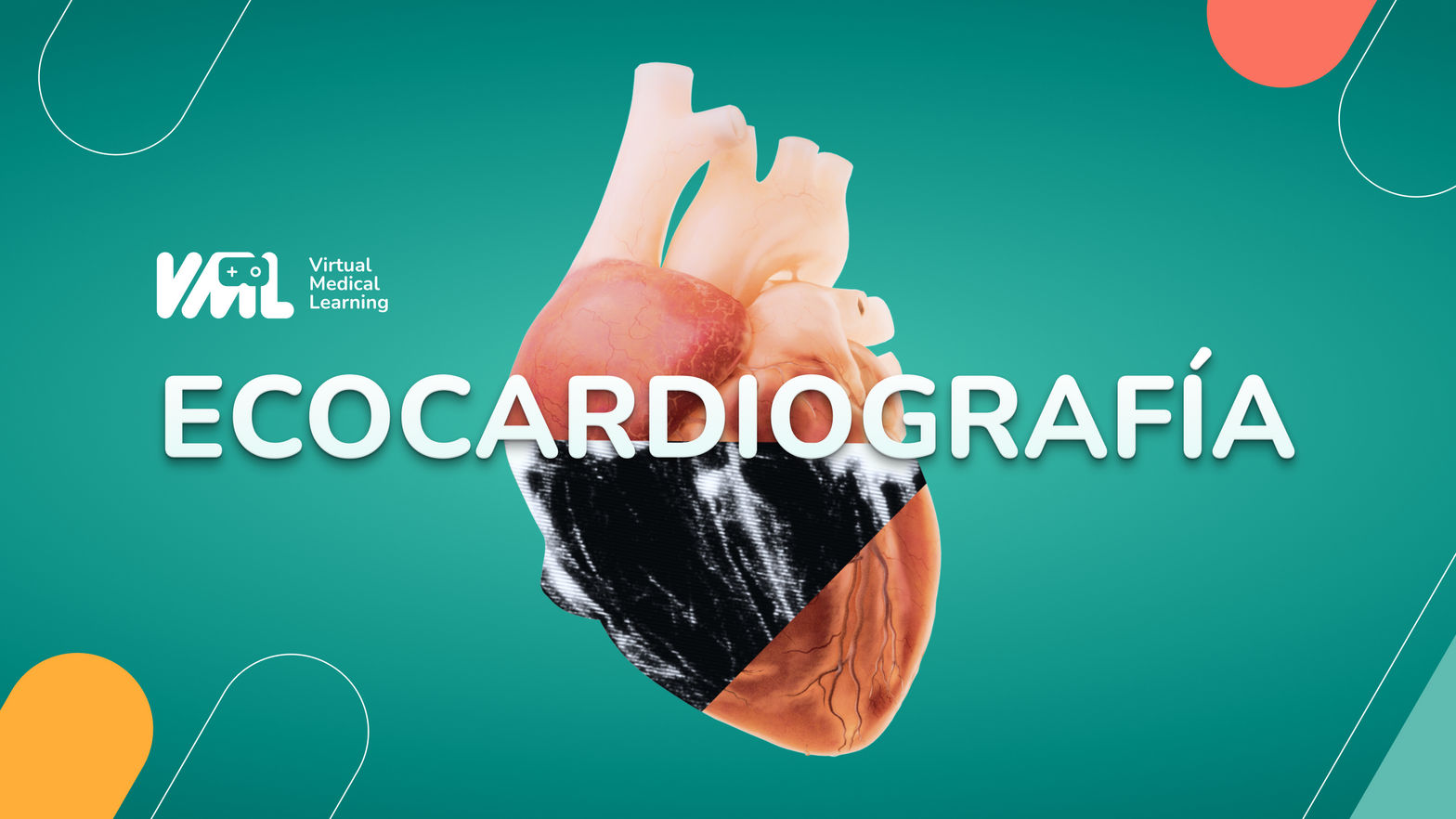 Echocardiography VR - VML