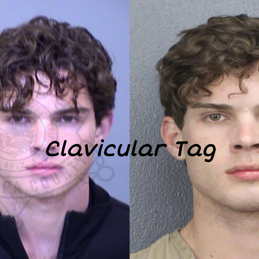 Clavicular Tag