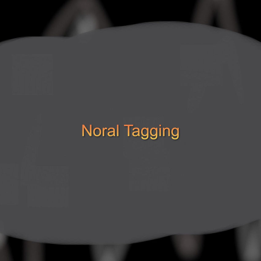 Noral Tagging
