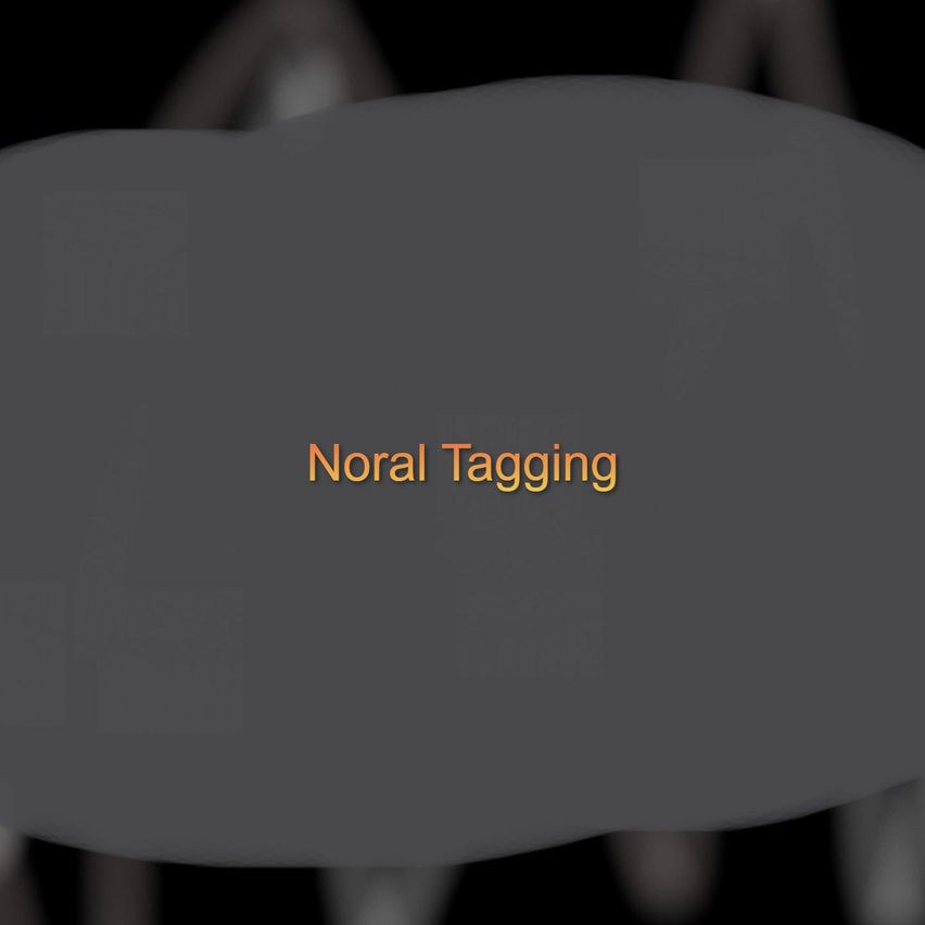 Noral Tagging